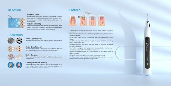 Ultra X - Ultrasonik Endo Aktivatör